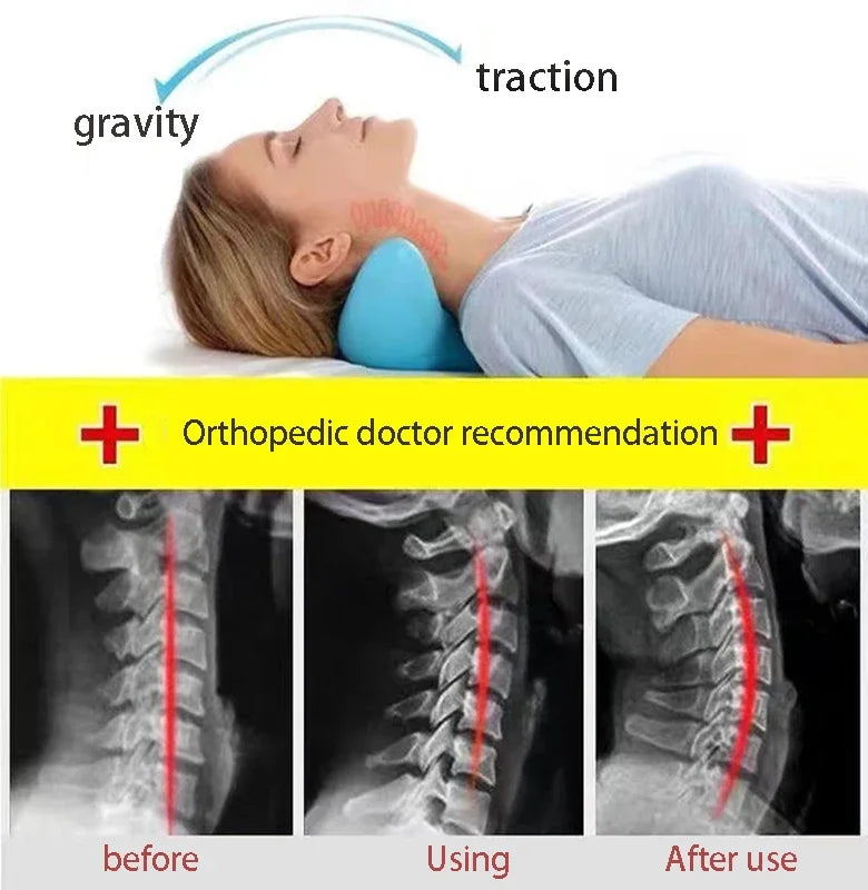VYRGE Cervical Neck Stretcher